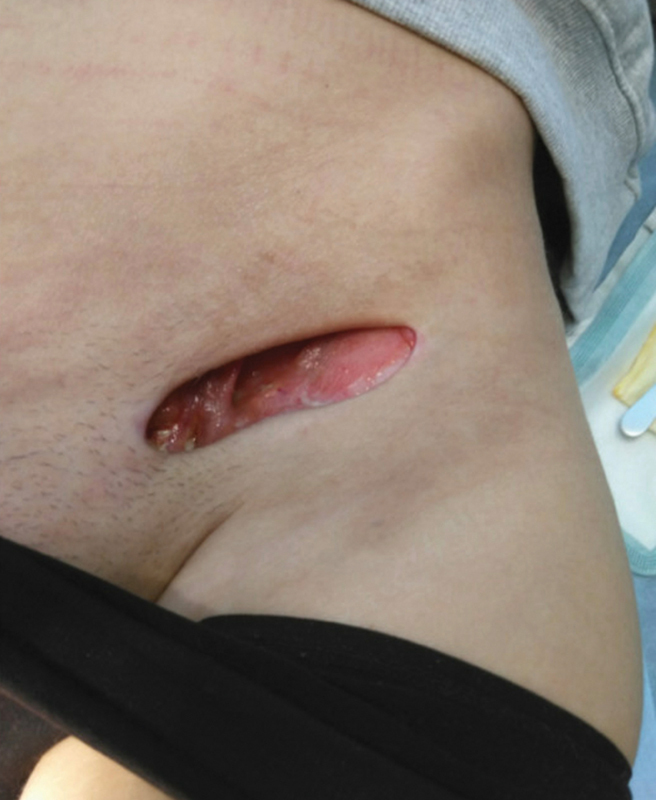 Fig. 4