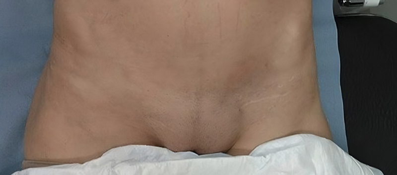Fig. 5