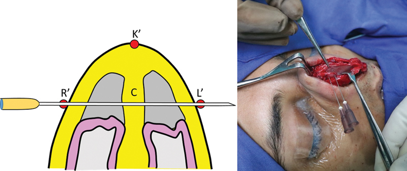 Fig. 10