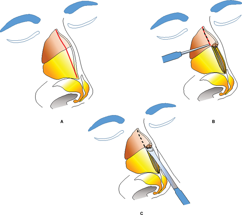 Fig. 11