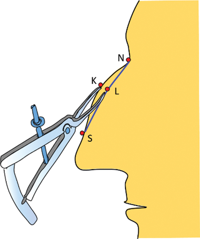 Fig. 5