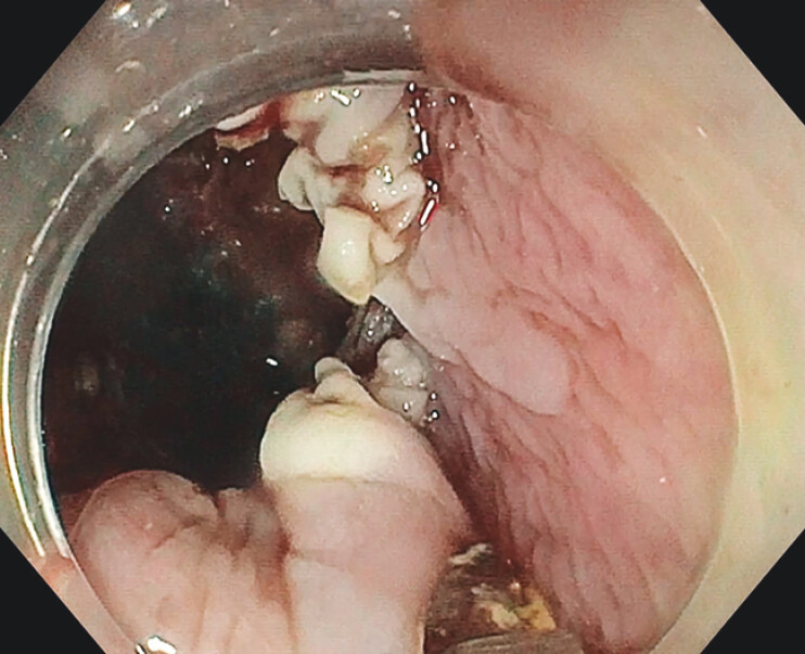 Fig. 3