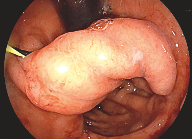 Fig. 1