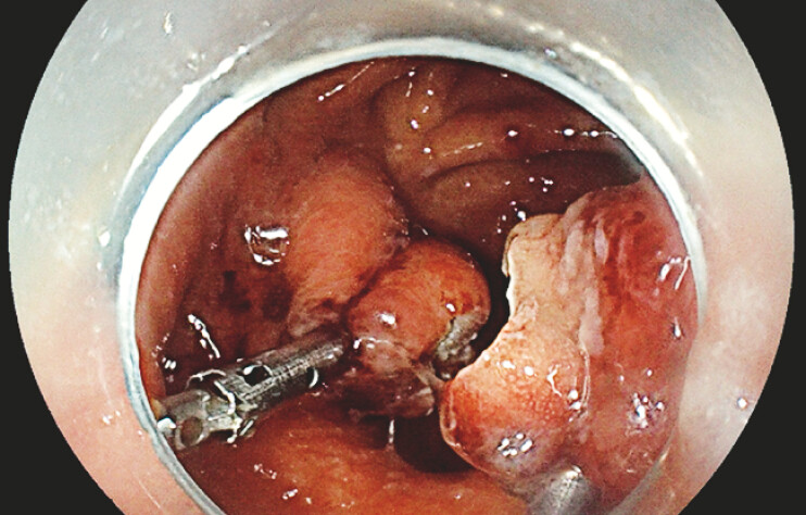 Fig. 5