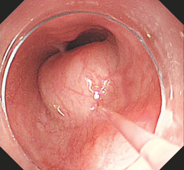 Fig. 2