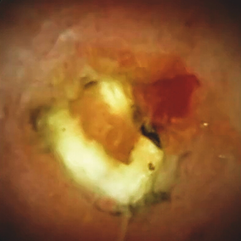 Fig. 3