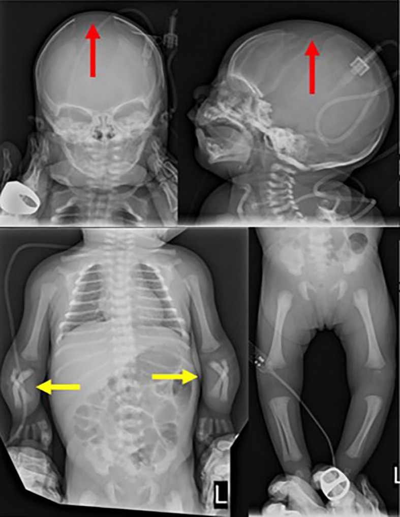 Figure 1
