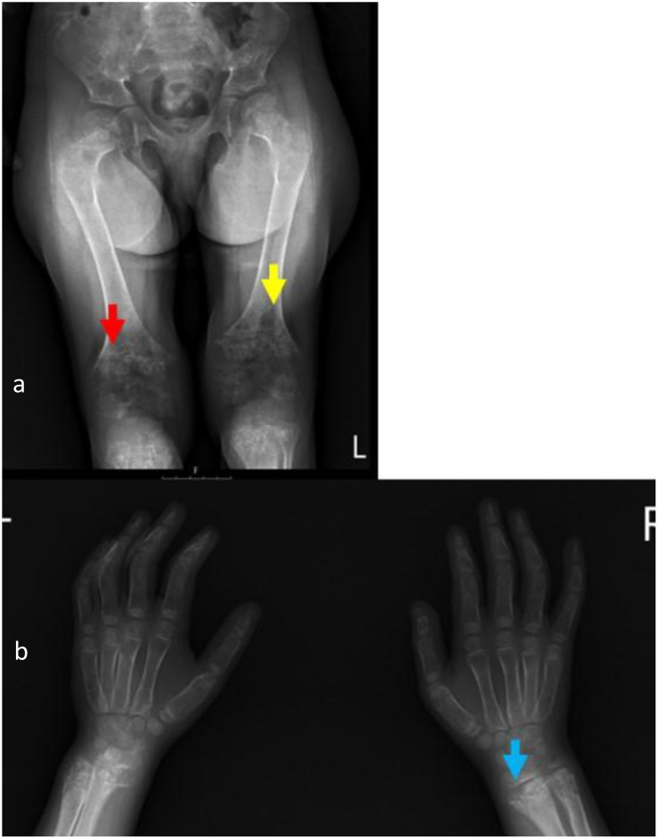 Figure 2