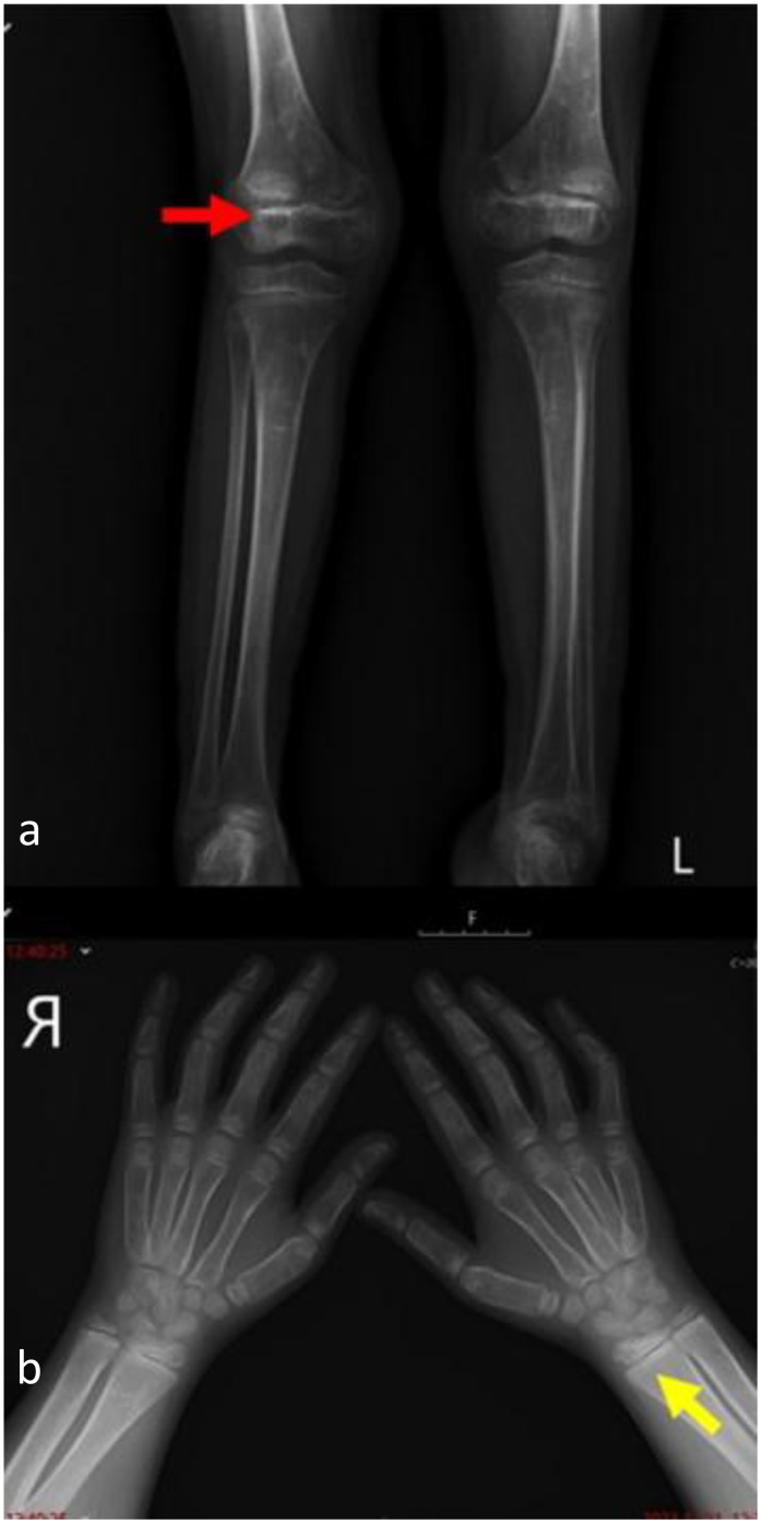 Figure 4