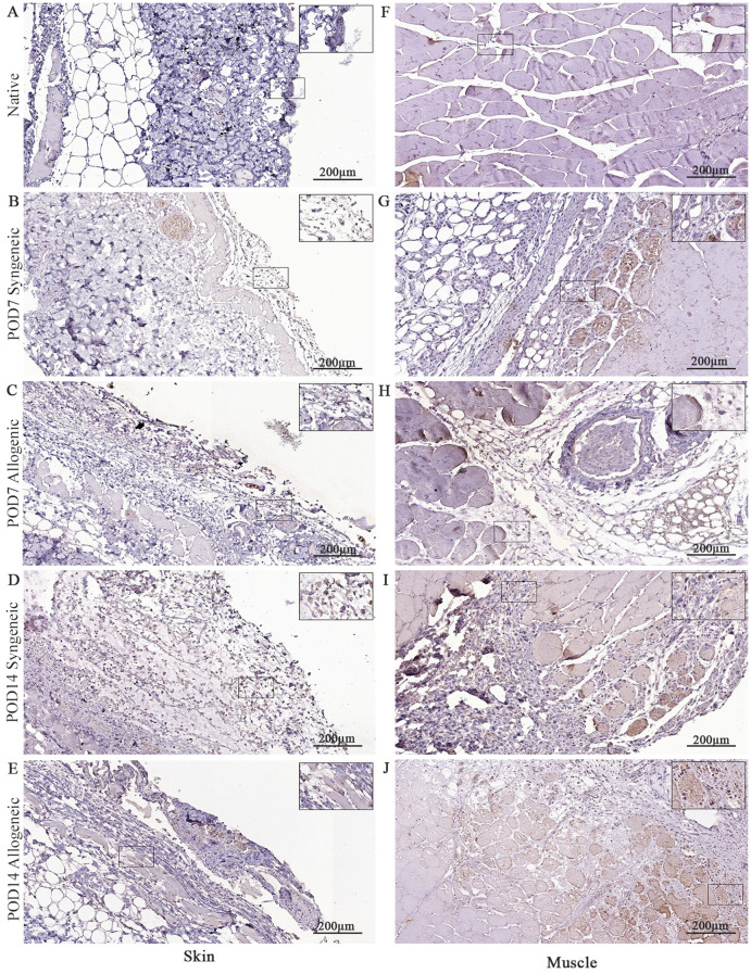 Figure 11