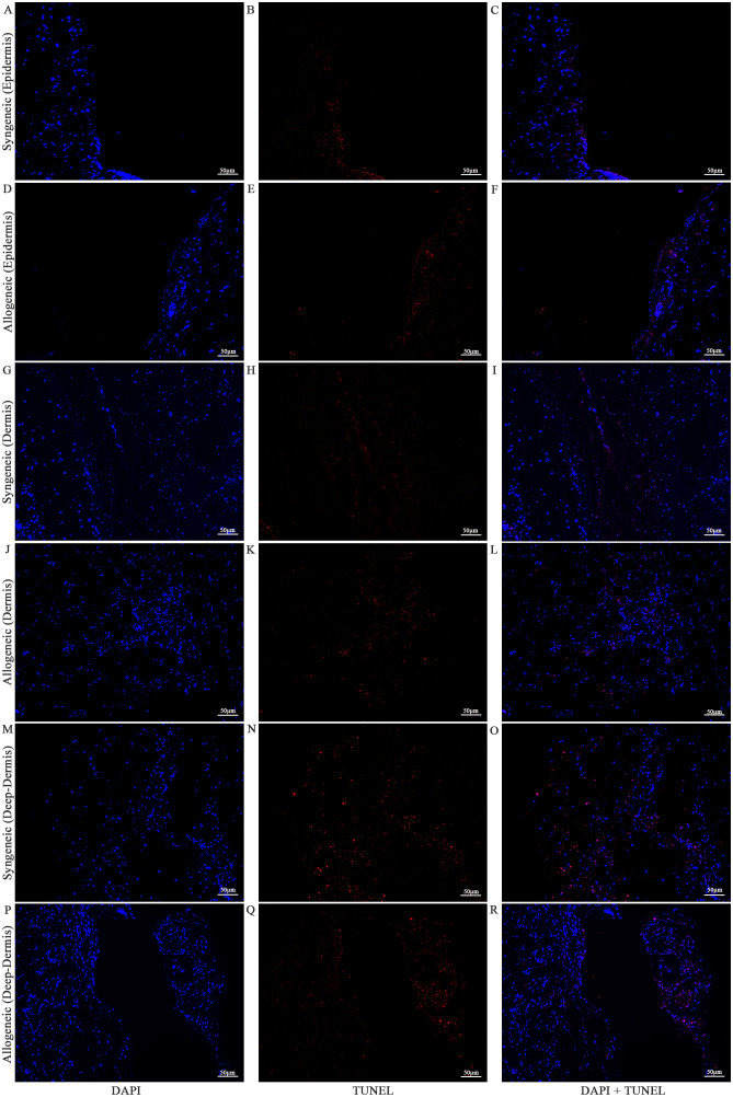 Figure 14