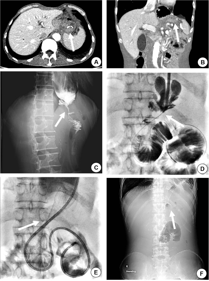 Figure 1