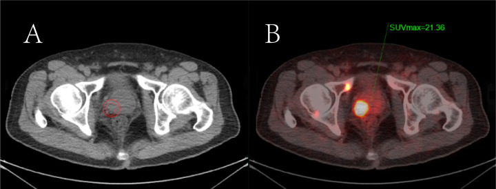 Figure 4