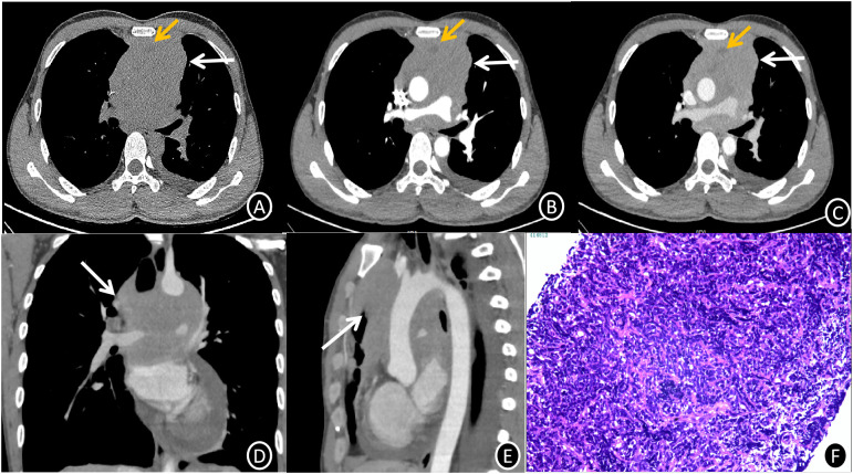 Figure 1