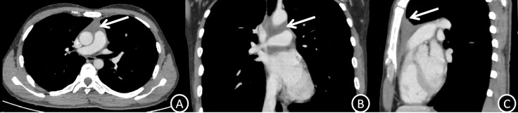 Figure 3
