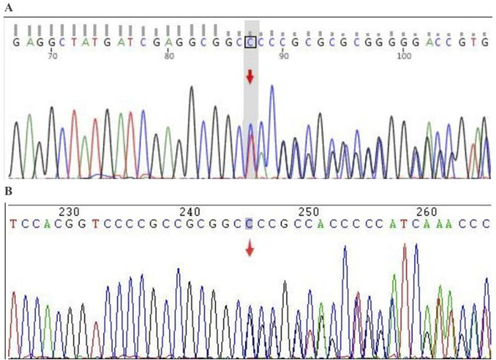 FIGURE 2