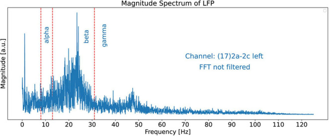 FIGURE 3