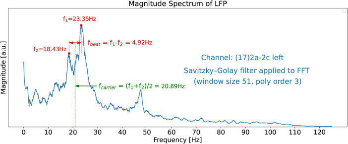 FIGURE 9