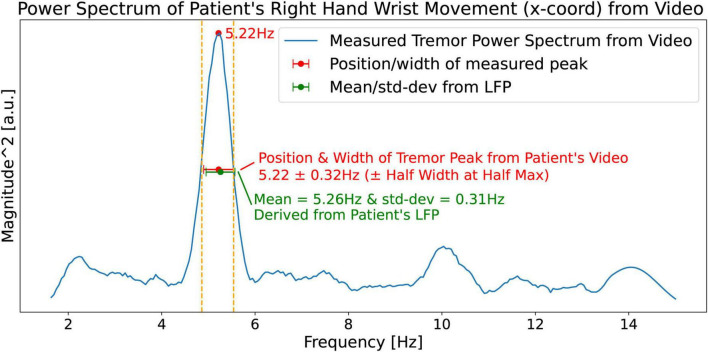 FIGURE 13