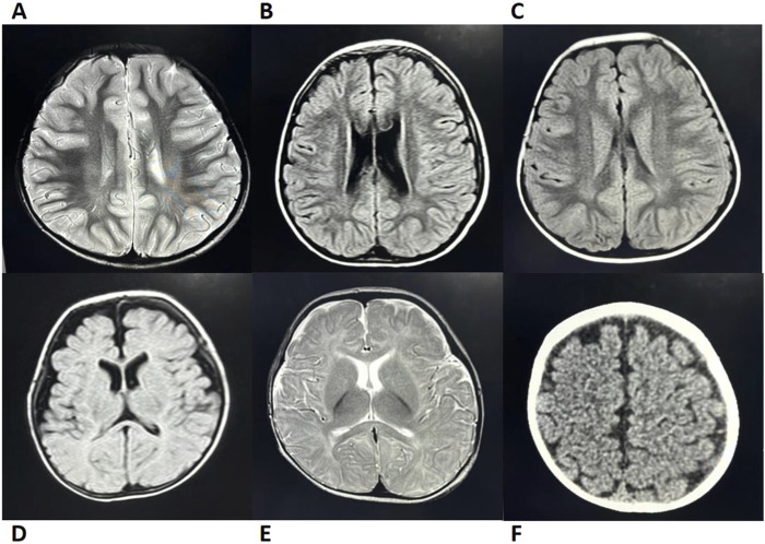 FIGURE 2