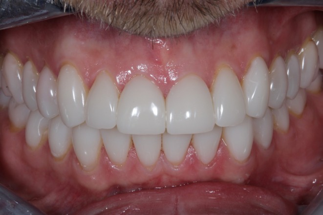 Figure 7