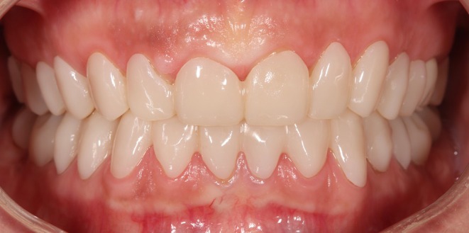 Figure 10