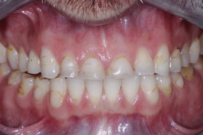 Figure 12