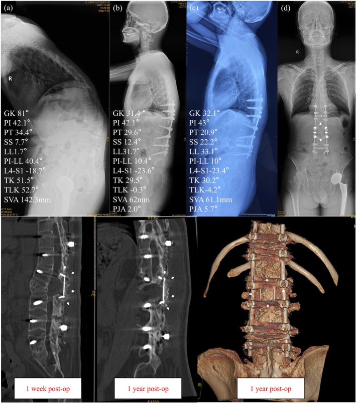 Figure 4