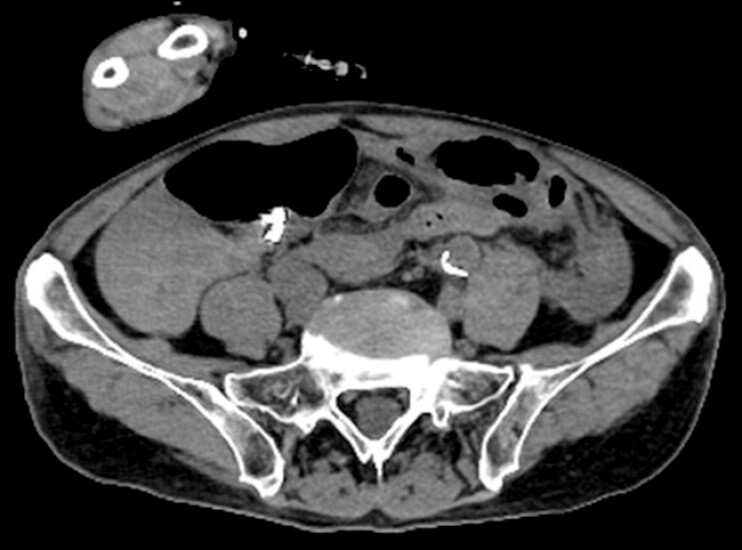 Fig. 3