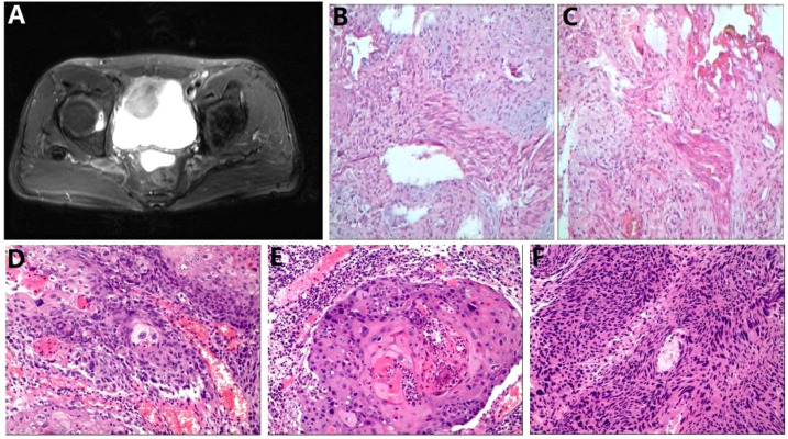 Figure 2