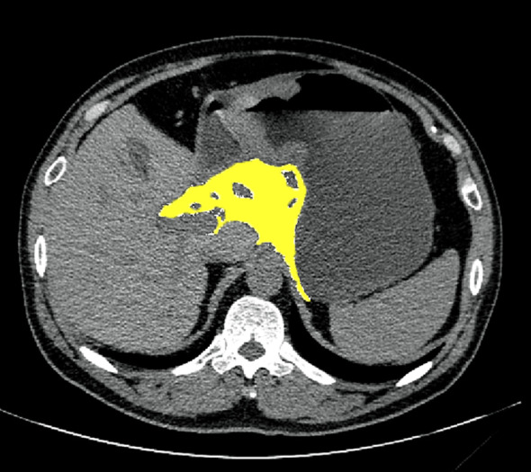 Figure 2