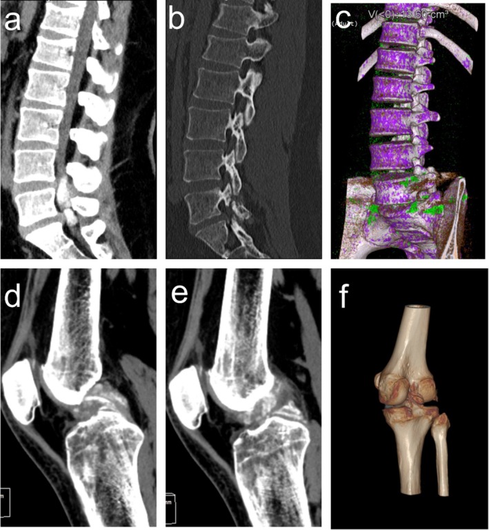 FIGURE 1