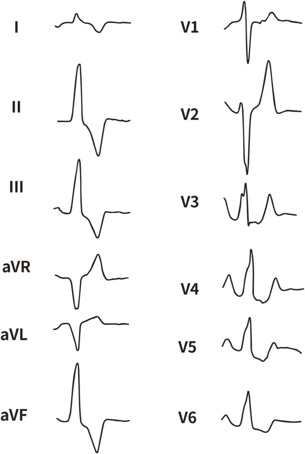 FIGURE 1