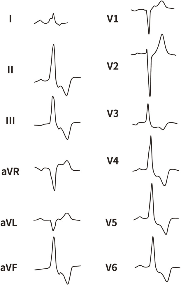 FIGURE 2