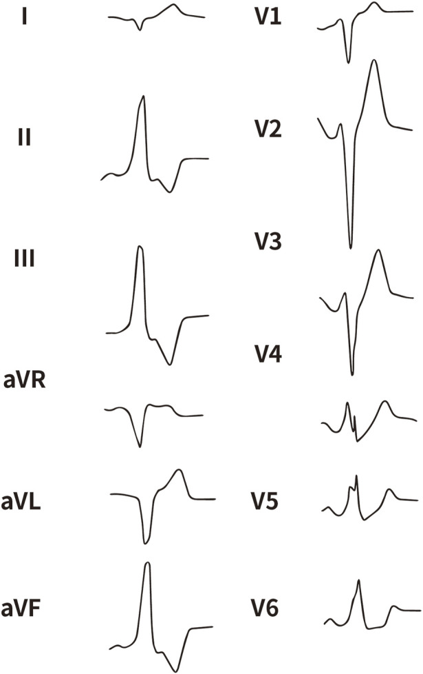 FIGURE 3