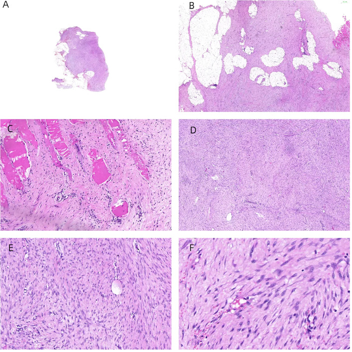 Figure 6