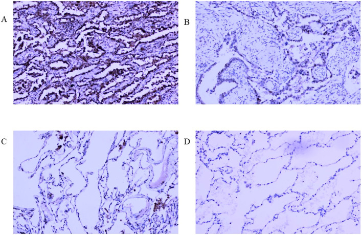 Figure 13