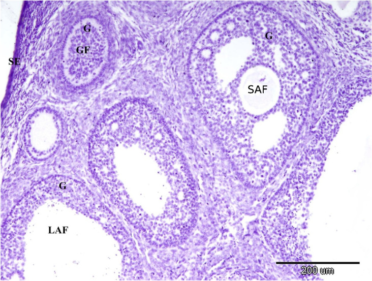 Figure 15