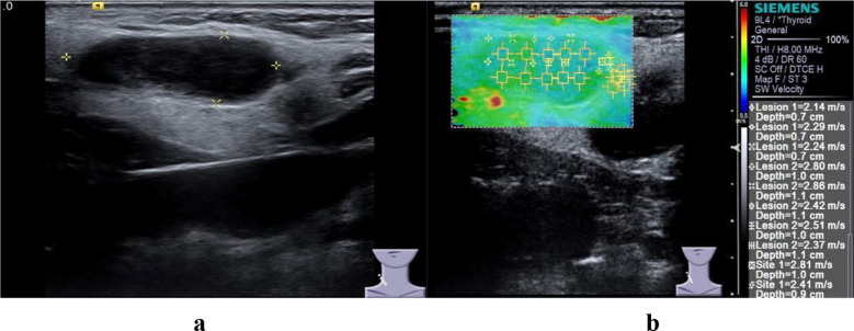Fig.3