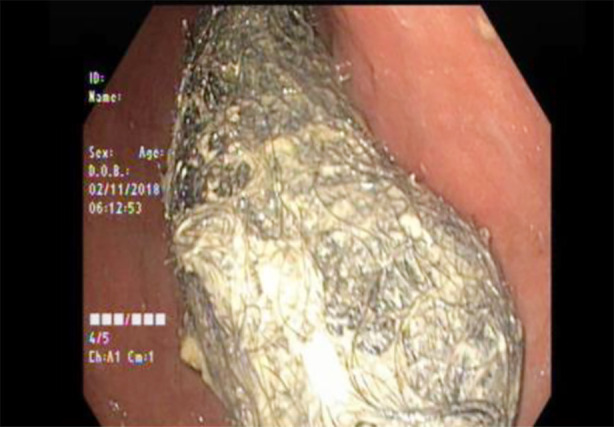 Fig.1