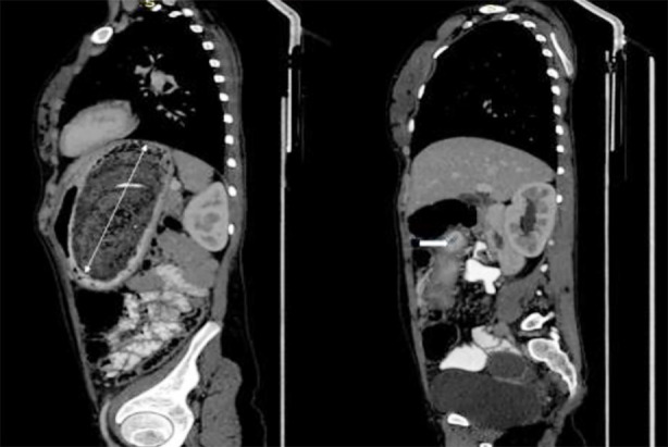 Fig.2