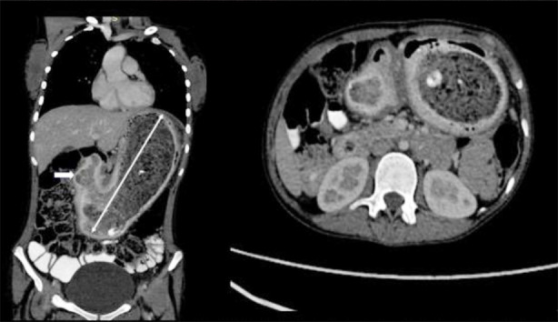 Fig.4