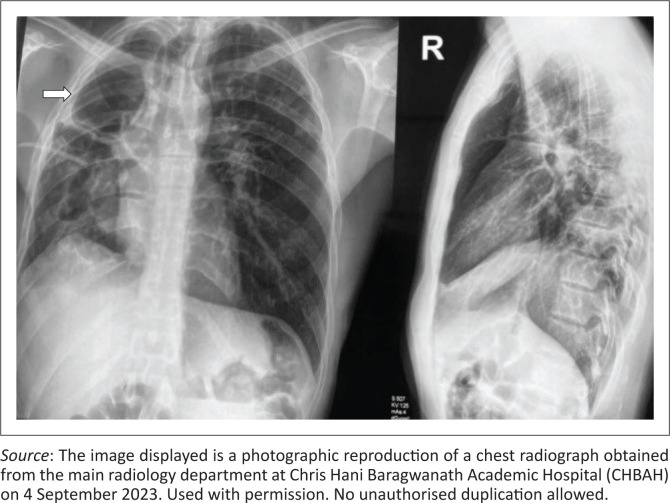 FIGURE 1