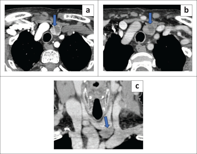 FIGURE 2