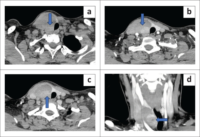 FIGURE 3