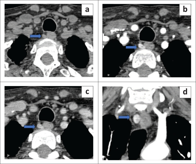 FIGURE 4