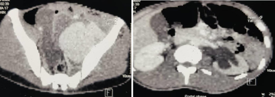 Figure 1c
