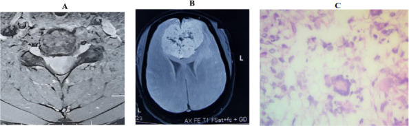 Figure 1A