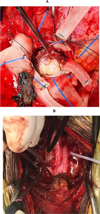 Figure 2A