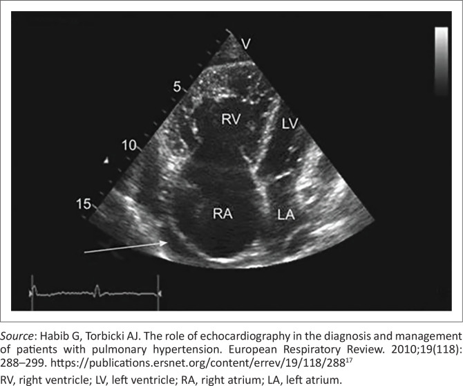 FIGURE 1